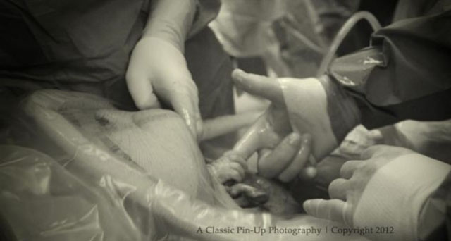ภาพทารกน้อยที่แอบจับมือคุณหมอ ขณะกำลังผ่าคลอด ที่มาภาพ : https://www.facebook.comphoto.phpfbid
